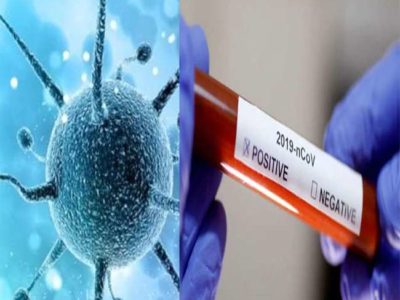 विधायक की रिपोर्ट भी  कोरोना पॉजिटिव