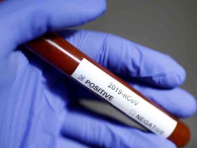 सागर 181, छतरपुर 20, दमोह 24, टीकमगढ़ 9, दतिया 8, पन्ना 6 मामले आए सामने