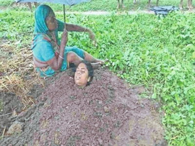 आकाशीय बिजली से झुलसे लोग, गड्ढे में गाड़कर किया इलाज