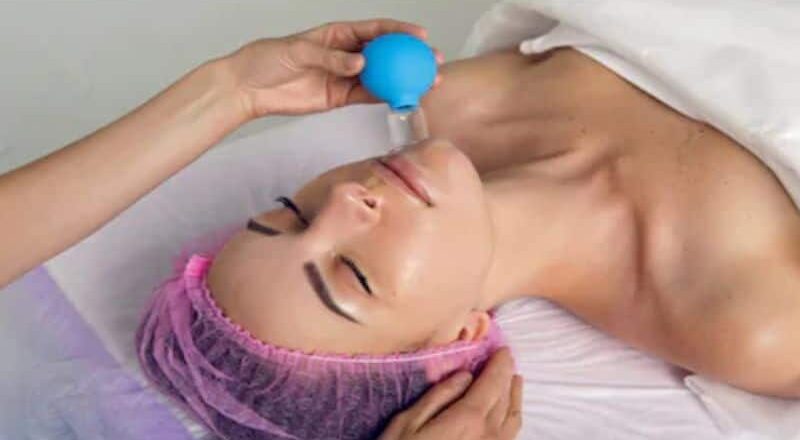 खूबसूरती को बरकरार रखने के लिए अपनाये कपिंग थेरेपी