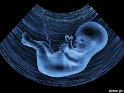 भ्रूण परीक्षण करने वाले की सूचना देने पर मिलेगा 2 लाख रुपए इनाम