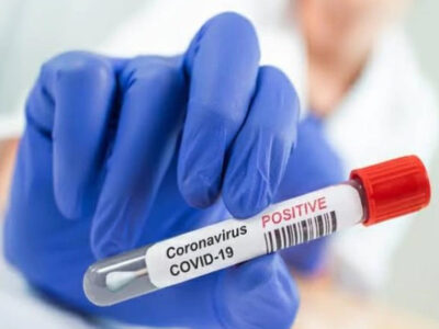 अमेरिका और दुबई से लौटे युवक व युवती पाई गई कोरोना पॉजिटिव
