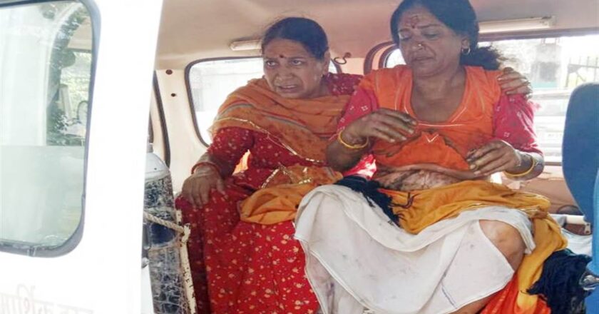 महाकाल मंदिर में महिला श्रद्धालु की साड़ी में लगी आग, हाथ और पैर झुलसे