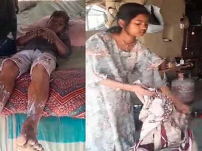 बाराबंकी में रसोई गैस के रेगुलेटर में रिसाव से लगी आग, पांच लोग झुलसे