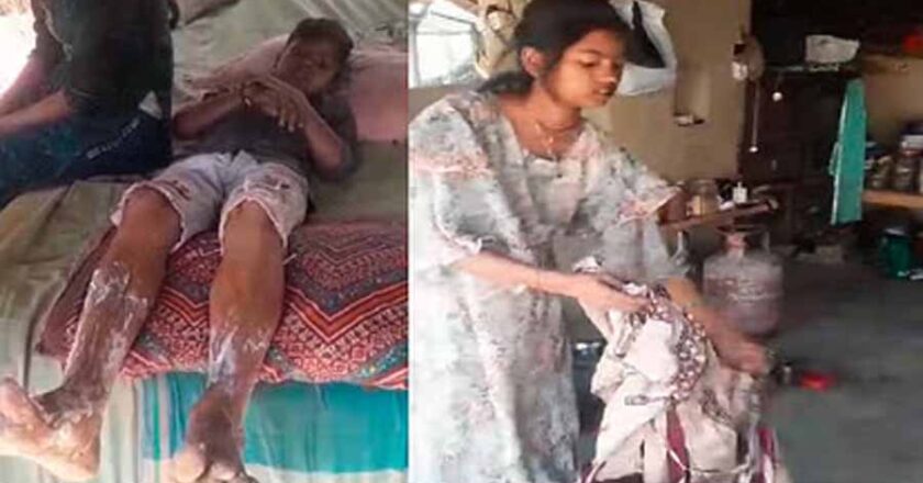 बाराबंकी में रसोई गैस के रेगुलेटर में रिसाव से लगी आग, पांच लोग झुलसे