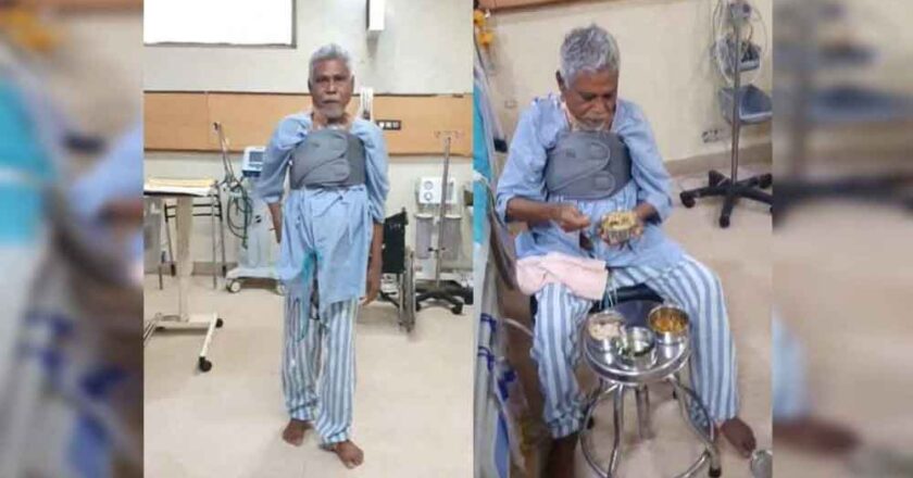 अंबेडकर अस्पताल ने ओपन हार्ट सर्जरी के क्षेत्र में जोड़ा नया अध्याय, बहुप्रतीक्षित कोरोनरी बाईपास सर्जरी की हुई शुरुआत