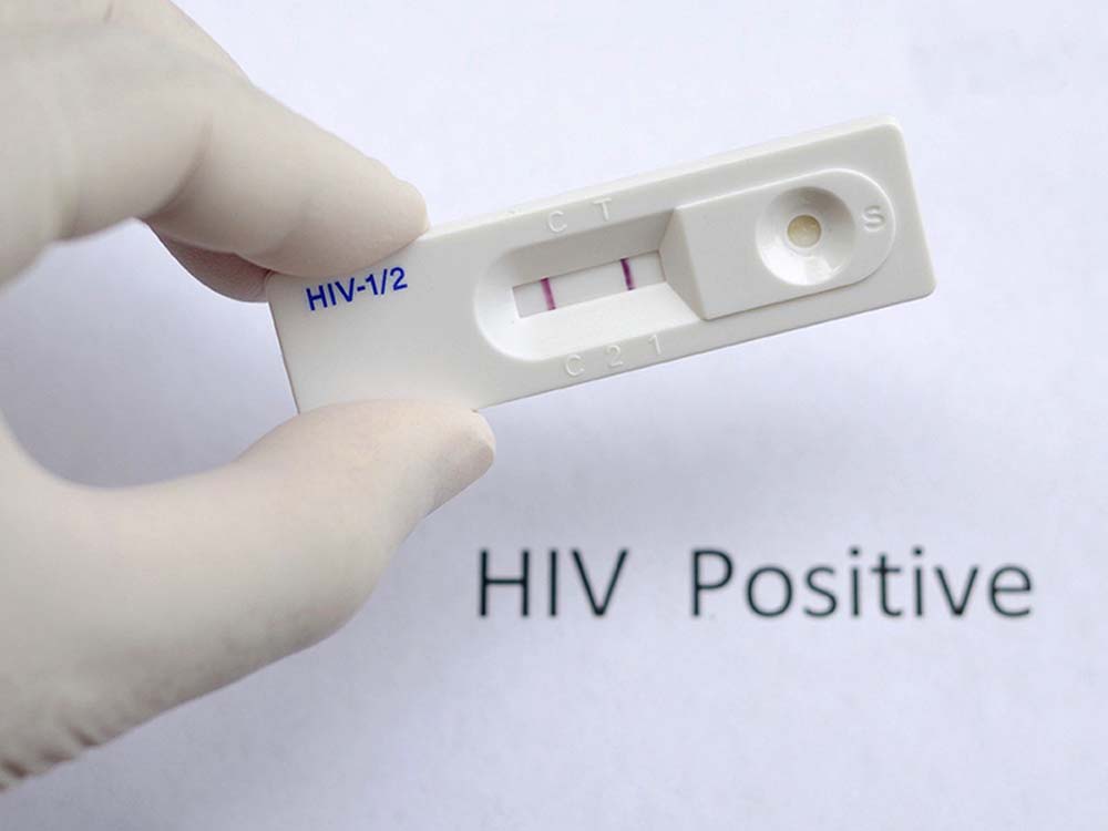 हरिद्वार की जिला कारागार से चौंकाने वाली खबर, 15 कैदी HIV पॉजिटिव, जेल प्रशासन में मचा हड़कंप