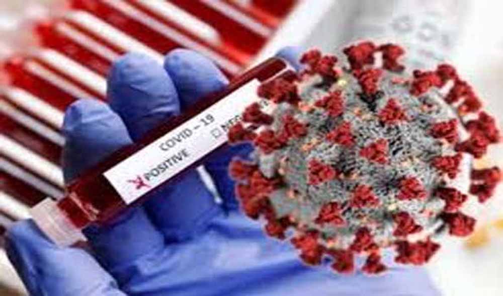 छत्तीसगढ़ में कोरोना वायरस के संक्रमण के मामले स्वास्थ्य विभाग हुआ सतर्क, संक्रमण के लक्षणों की निगरानी के लिए जारी किया नया प्रोटोकॉल