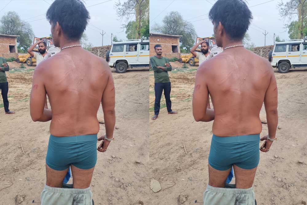 रेत खदान बलबहरा के कर्मचारियों से मारपीट का मामला प्रकाश में आया