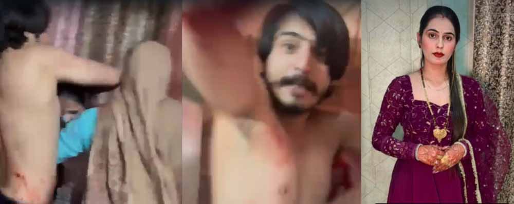 ग्रेटर नोएडा में दिल दहला देने वाली वारदात: निक्की को बेरहमी से पीटा और जिंदा जलाया