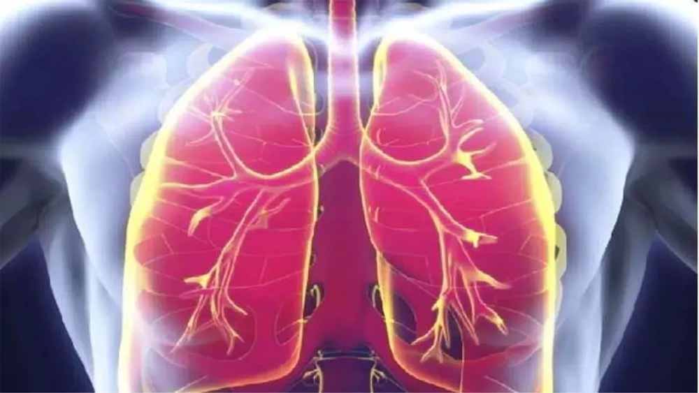 मध्य प्रदेश में ‘मेलिओइडोसिस’ का खतरा बढ़ा, लक्षणों से डॉक्टर भी हो रहे भ्रमित