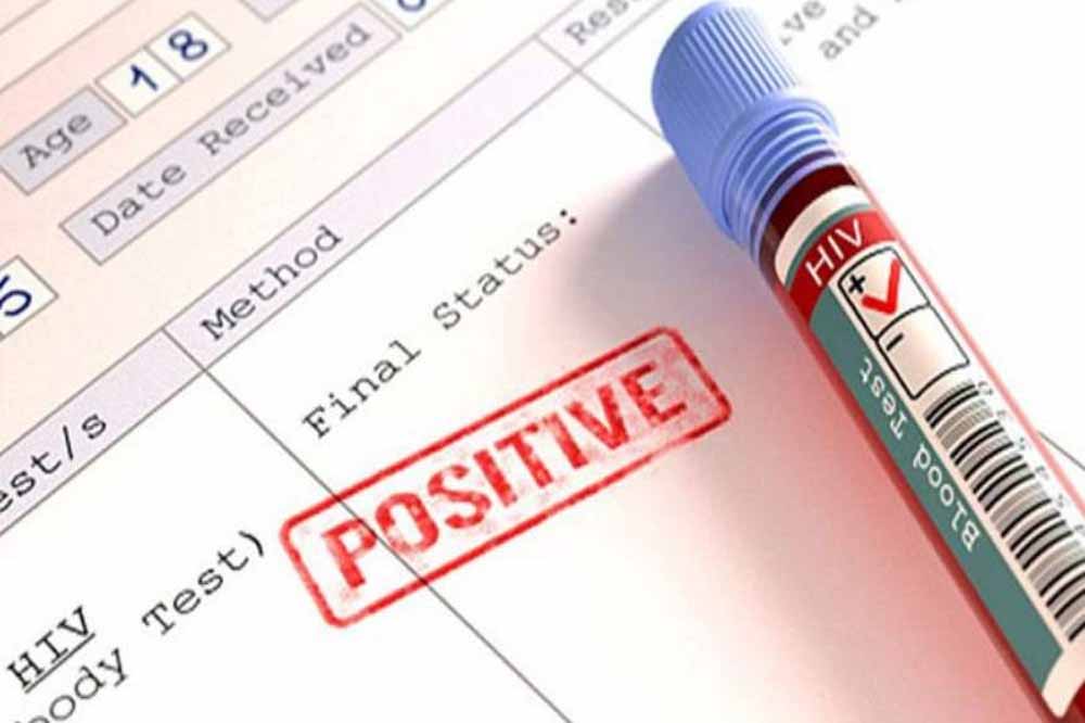 HIV रिपोर्ट गोपनीयता पर नई गाइडलाइन: अब सिर्फ डॉक्टर ही देख सकेंगे मरीज की जानकारी