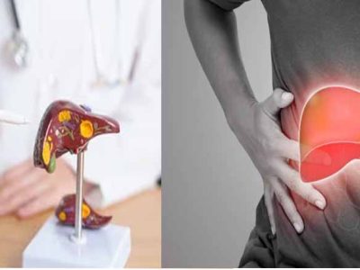 आपका लिवर हेल्दी है या खराब? घर बैठे 20 सेकेंड में अभी टेस्ट करें!