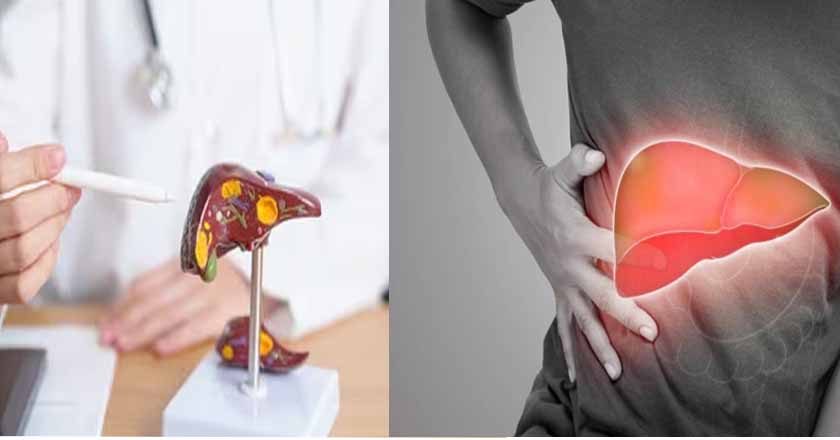 आपका लिवर हेल्दी है या खराब? घर बैठे 20 सेकेंड में अभी टेस्ट करें!