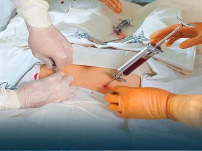 थैलीसीमिया मरीजों को राहत: निःशुल्क बोन मैरो ट्रांसप्लांट और 1250 रुपए मासिक पेंशन, बायोमेट्रिक जरूरी नहीं