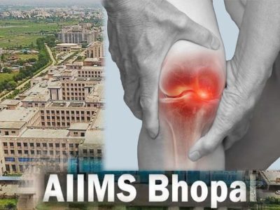 घुटनों के दर्द से मिलेगी परमानेंट मुक्ति, एम्स भोपाल और ग्वालियर आयुर्वेद संस्थान मिलकर खोजेंगे अचूक इलाज