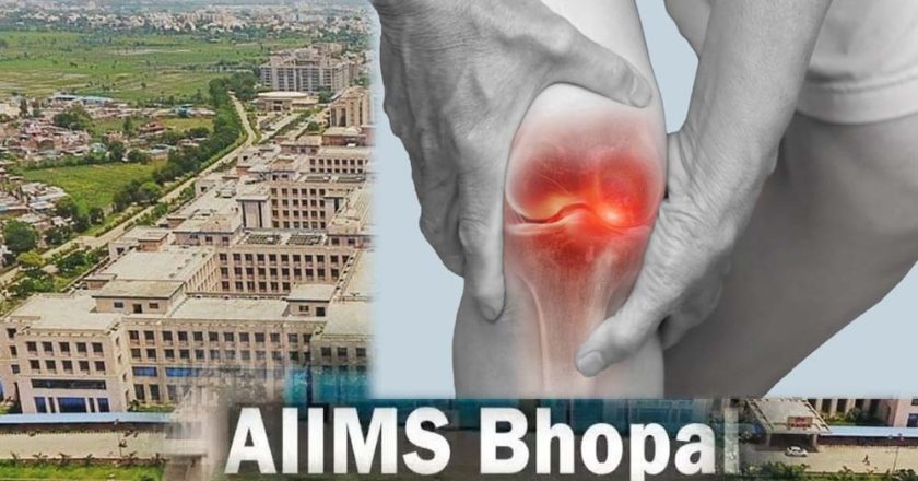 घुटनों के दर्द से मिलेगी परमानेंट मुक्ति, एम्स भोपाल और ग्वालियर आयुर्वेद संस्थान मिलकर खोजेंगे अचूक इलाज
