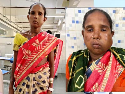 रायपुर: संजीवनी बना मेगा सुपर स्पेशलिटी हेल्थ कैंप, बुधरी मड़कम को मिला नया जीवन