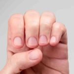 क्या आपके नाखून भी हो रहे हैं पीले या नीले? जानें शरीर में छिपी किन बीमारियों की ओर है यह इशारा