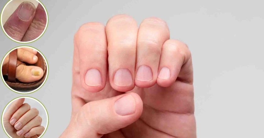 क्या आपके नाखून भी हो रहे हैं पीले या नीले? जानें शरीर में छिपी किन बीमारियों की ओर है यह इशारा