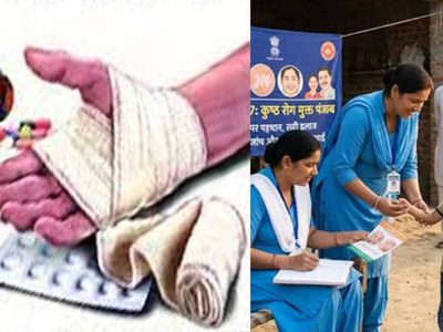 पंजाब में बढ़ी चिंता: कुष्ठ रोग के 352 एक्टिव केस, बच्चों में लक्षणों ने बढ़ाया खतरा