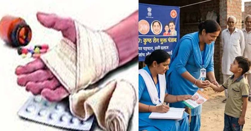 पंजाब में बढ़ी चिंता: कुष्ठ रोग के 352 एक्टिव केस, बच्चों में लक्षणों ने बढ़ाया खतरा