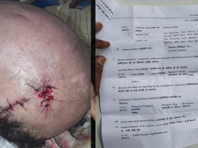 अधिमान्य पत्रकार नेतृत्व समिति के प्रदेश कार्यवाहक अध्यक्ष पर प्राण घातक हमला